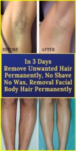 REMOVE UNWANTED HAIR PERMANENTLY IN THREE DAYS, NO SHAVE NO WAX, REMOVAL FACIAL & BODY HAIR PERMANENTLY