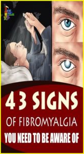 43 Signs of Fibromyalgia You Should Be Aware Of