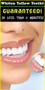 GUARANTEED! WHITEN YOUR YELLOW TEETH IN LESS THAN 2 MINUTES!