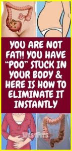 YOU ARE NOT FAT!! YOU HAVE “POO” STUCK IN YOUR BODY & HERE IS HOW TO ELIMINATE IT INSTANTLY