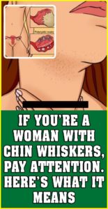 IF YOU’RE A WOMAN WITH CHIN WHISKERS, PAY ATTENTION. HERE’S WHAT IT MEANS!