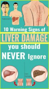 10 Warning Signals of Liver Damage You Should Not Ignore