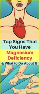 Top Signs That You Have Magnesium Deficiency and What to Do About It