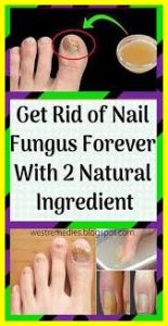 3 Simple and Effective Natural Cures for Toenail Fungus