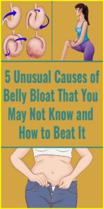 5 Unusual Causes of Bloated Belly and How to Beat It