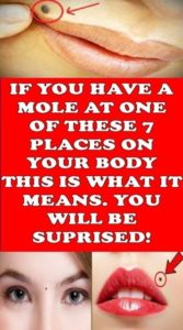 IF YOU HAVE A MOLE AT ONE OF THESE 7 PLACES ON YOUR BODY THIS IS WHAT IT MEANS. YOU WILL BE SURPRISED!