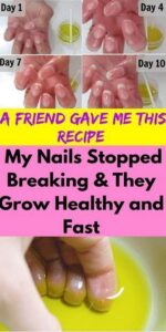A FRIEND GAVE ME THIS RECIPE AND MY NAILS STOPPED BREAKING AND THEY GROW HEALTHY AND FAST